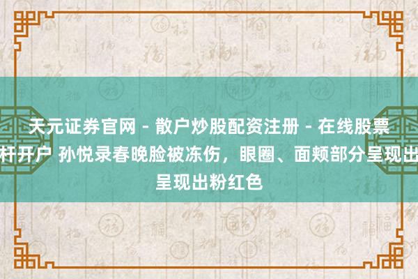 天元证券官网 - 散户炒股配资注册 - 在线股票如何杠杆开户 孙悦录春晚脸被冻伤，眼圈、面颊部分呈现出粉红色